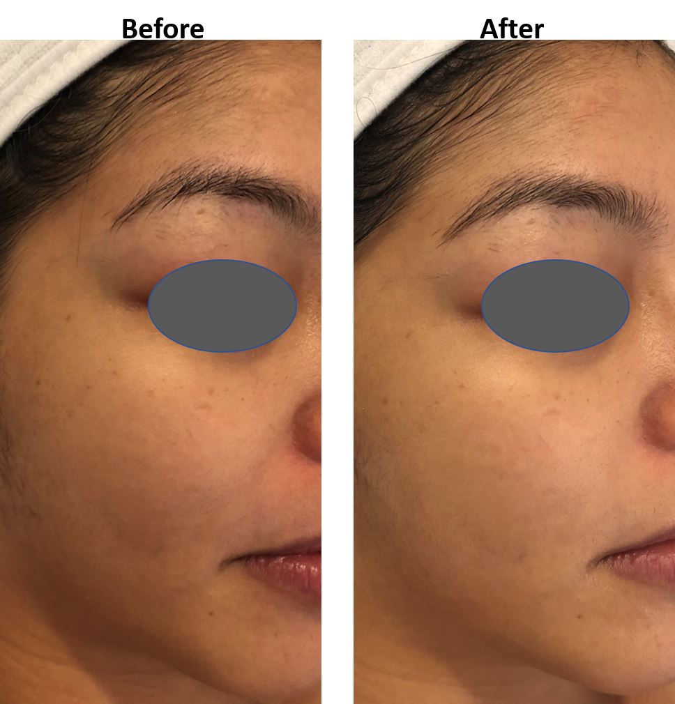 WishPro Repairing Formula