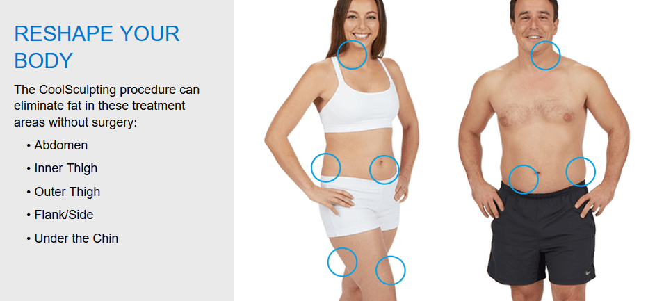 āļāļļāļāļāļĩāđāļĢāļąāļāļĐāļēāđāļāđāļāđāļ§āļĒ CoolSculpting - āļŠāđāļ§āļāļāđāļēāļāđ āļāļāļāļĢāđāļēāļāļāļēāļĒ